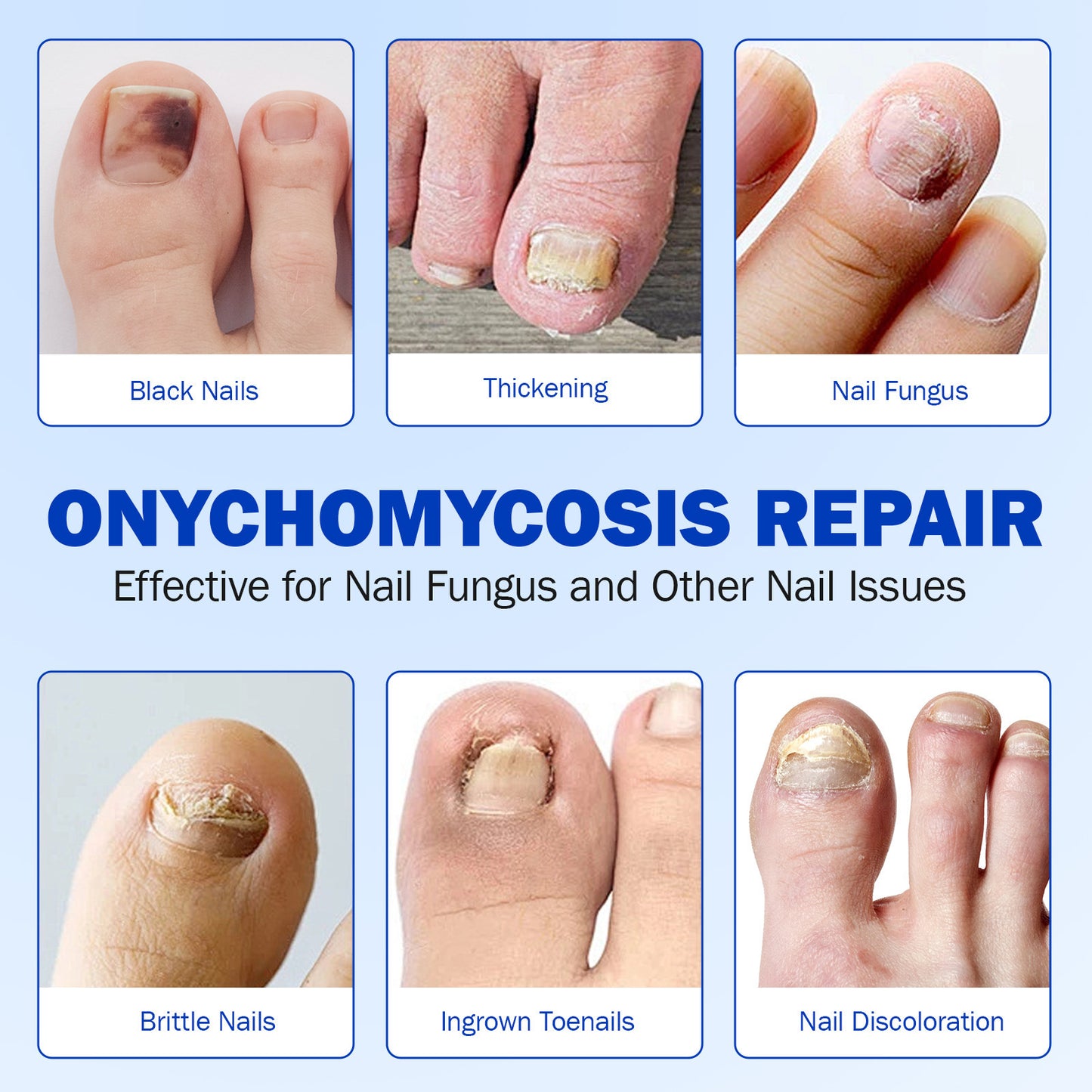 Fungal Nail Renew Patches
