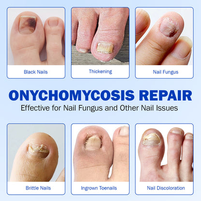Fungal Nail Renew Patches
